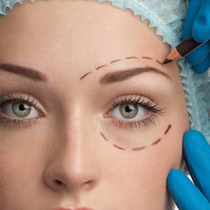 blefaroplastia