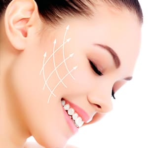 Facelift